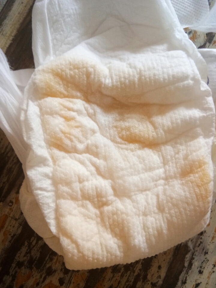 九个月宝宝小便有点黄_尿后提裤子滴尿正常吗_宝宝尿裤子变黄小便有问题吗