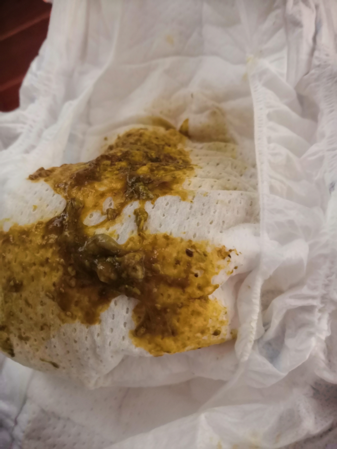 七个月宝宝拉稀_嗯宝宝拉稀_宝宝腹泻稀便