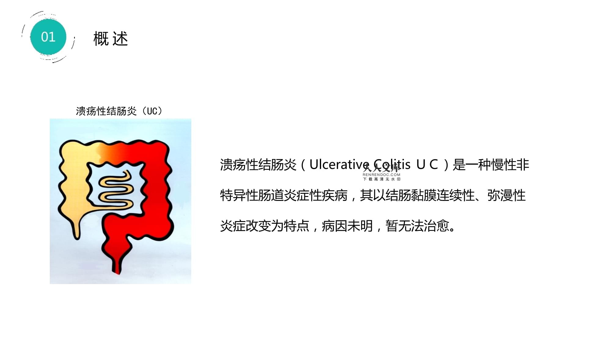 手机游戏与肠炎_手机游戏与肠炎_手机游戏与肠炎